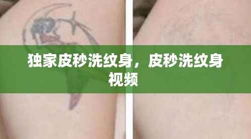 独家皮秒洗纹身,皮秒洗纹身视频